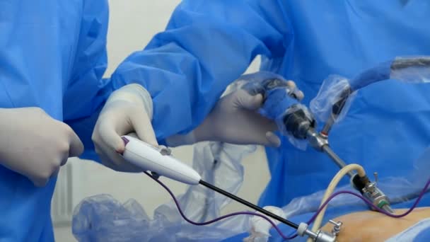 Doctors Surgeons Operate Laparoscope Laperoscopy Surgical Operation Removal Malignant Benign — Stock Video