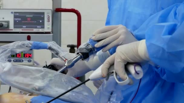 Chernihiv Ukraine February 2023 Doctors Surgeons Operate Laparoscope Laperoscopy Surgical — Stock Video
