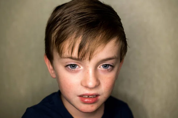 一个脸上有擦伤的斯拉夫式悲伤的小男孩 — 图库照片