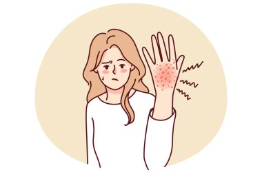 Unhappy woman suffer from redness on hand. Unwell girl struggle with psoriasis or seasonal allergy. Healthcare concept. Vector illustration.