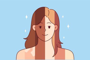Vücudunda farklı ten renkleri ve vitiligo lekeleri olan kadın insanlar ve ırk toleransı arasındaki farkı sembolize eder. Farklı ırklar ve etnik kökenlerin birliği ve ayrımcılık eksikliği kavramı