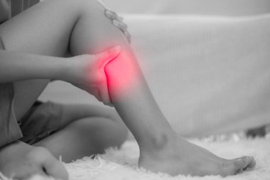 Derin ven trombozu ve varis. Kız bacaklarına dokunuyor ve damarlara bakıyor. Konuk damar cerrahı doktorunda skleroterapi prosedürü