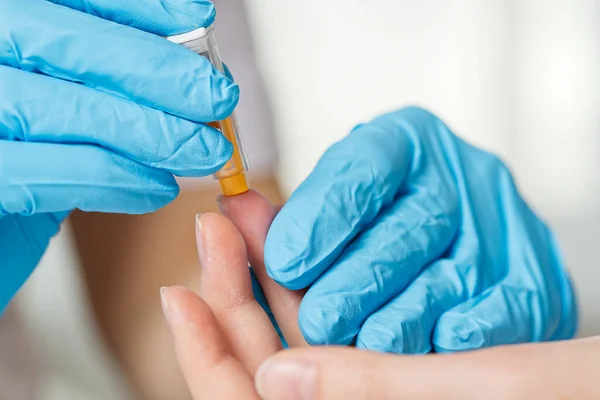Läkare Piercing Patienter Finger Med Lancet Kliniken Närbild Tar Blod — Stockfoto