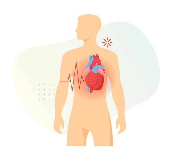 Symptome Eines Herzinfarkts Archivbild Als Eps Datei — Stockvektor