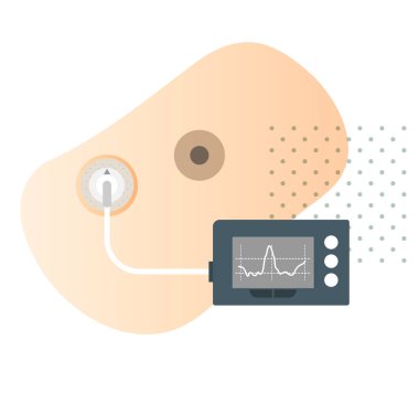 İnsülin Diyabet Pompası - EPS 10 Dosyası Olarak Stok Resimleri