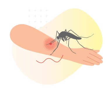 EPS 10 Dosyası Olarak İnsan Cildinde Sivrisinek Isırması - Stok İllüstrasyonu