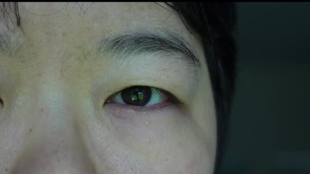 Asiatico Donna Occhio Prurito Lampeggiante Con Stye Rosso Occhio Infettato — Video Stock