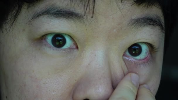 アジアの女性は 染料と赤い目の飲み物で点滅するかゆみが感染しました — ストック動画