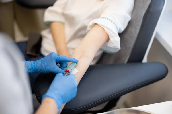 Processo Assunzione Sangue Venoso Una Provetta Laboratorio Primo Piano — Foto Stock