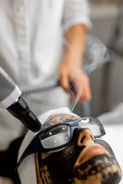 Beauty procedure of laser carbon peeling on womans face. Close-up on clients face in carbon mask and protective eyeglasses. Concept of beauty facial treatments