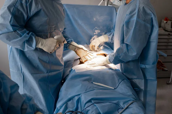 Dois Cirurgiões Operam Área Abdominal Paciente Conceito Operação Real Intervenção — Fotografia de Stock