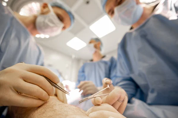 Kirurgit Suorittavat Kirurgisen Toimenpiteen Laaja Näkymä Alhaalta Leikkauspaikalta Keskittyi Lääketieteellisiin — kuvapankkivalokuva