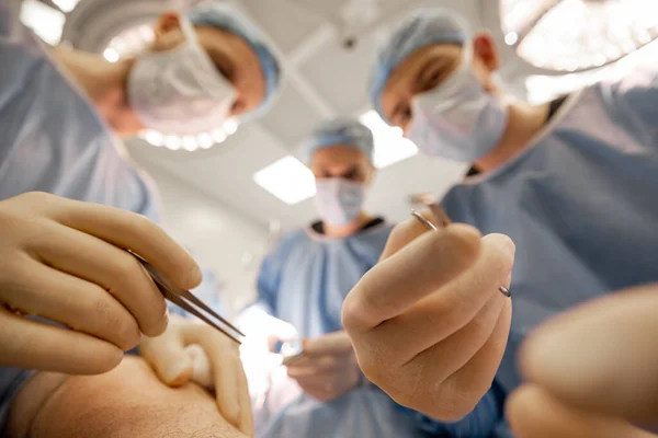 Kirurgit Suorittavat Kirurgisen Toimenpiteen Laaja Näkymä Alhaalta Leikkauspaikalta Keskittyi Lääketieteellisiin — kuvapankkivalokuva