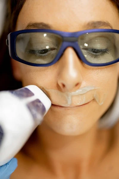 Giovane Donna Glasse Durante Procedura Depilazione Sul Labbro Superiore Salone — Foto Stock