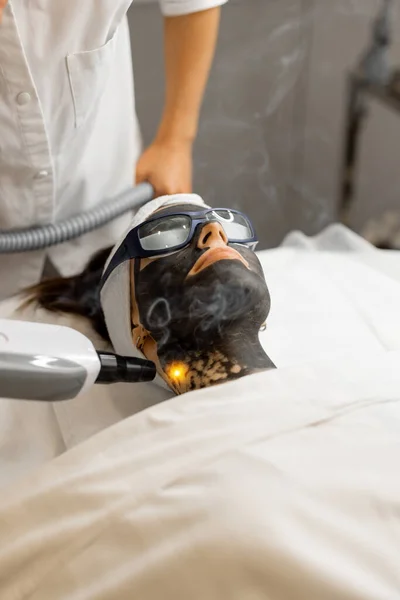 Beauty procedure of laser carbon peeling on womans face. Close-up on clients face in carbon mask and protective eyeglasses. Concept of beauty facial treatments