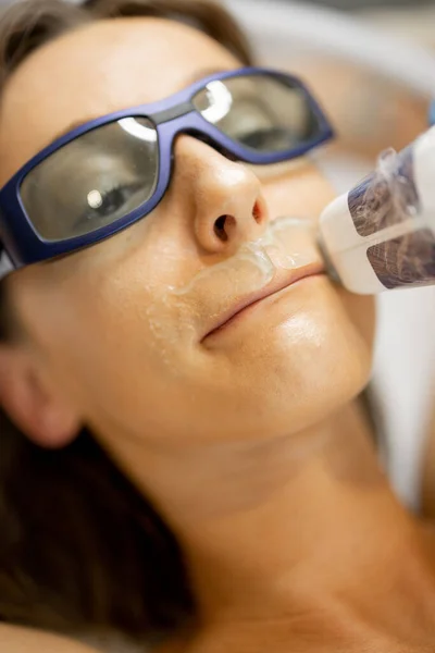 Mulher Jovem Glasse Durante Procedimento Remoção Cabelo Seu Lábio Superior — Fotografia de Stock