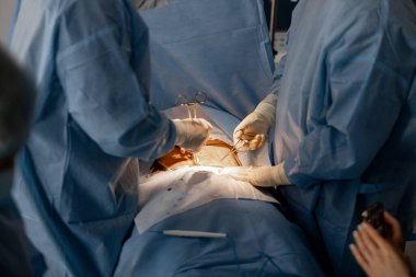 İki cerrah bir hastanın karın bölgesini ameliyat eder. Gerçek operasyon ve cerrahi müdahale kavramı