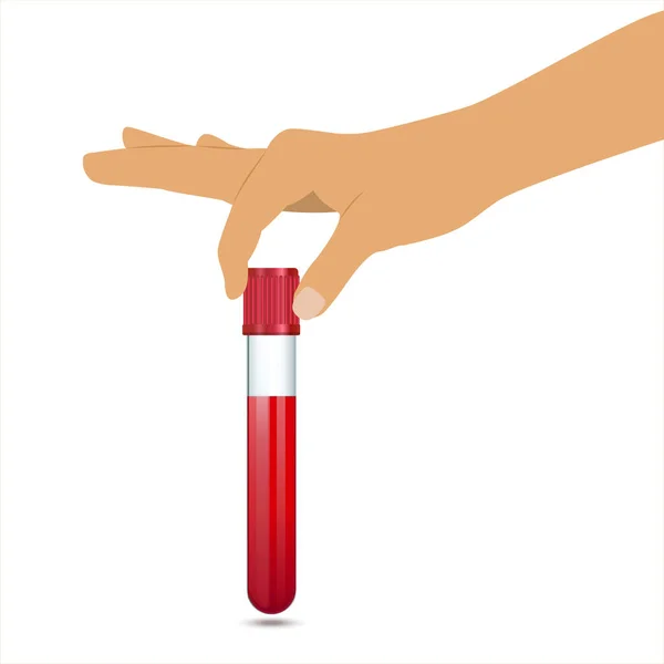 Ręka Lekarza Trzymająca Probówkę Próbką Krwi Badań Badacz Trzyma Próbkę — Wektor stockowy