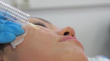 Yüz ozonu terapisi seansının yakın çekimi. Eldiven giyen bir kozmetik uzmanı şırınga kullanarak hastaların derisinin altına enjeksiyon yapıyor. İşlem, cilt dokusunun yenilenmesini ve iyileştirilmesini amaçlıyor.