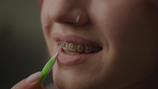 Zahnspangen Mit Bürste Reinigen Weibchen Putzen Ihre Zähne Mit Zahnspangen — Stockvideo