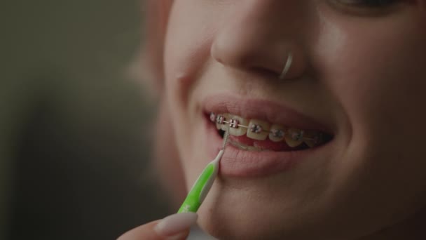Diş Teli Temizleme Işlemi Dişlerini Özel Bir Fırçayla Fırçalayan Kadın — Stok video