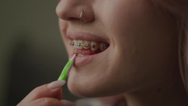 Female Cleaning Dental Braces Brush Close Woman Brushing Her Teeth — Stock Video