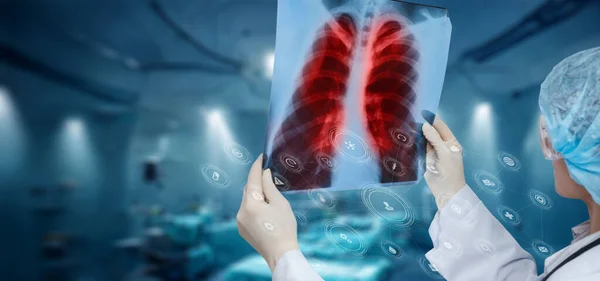 Arzt Untersucht Einen Schnappschuss Der Lungen Büro Auf Verschwommenem Hintergrund — Stockfoto