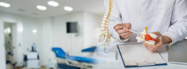 Omurilik fıtığı konsültasyonu. Klinikteki masada omurgalar arası fıtık gösteren bir doktor var..