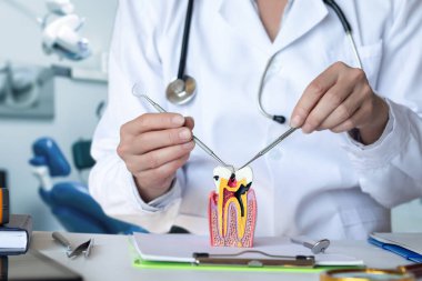 Diş Hekimliğinde Hasarlı Diş Modeli Gösteriliyor.