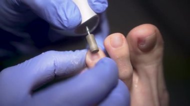 Kapatın. Mavi eldivenli bir podolojist tırnak tırnağı parmaklarını aşındırıcı bir başlıklı mekanik bir aletle parlatıyor. Üst Manzara. Podolojist müşterilerin derilerini öğütür.