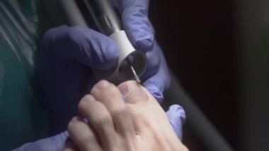 Mavi eldivenli bir podolojist tırnak tırnağı parmaklarını aşındırıcı bir başlıklı mekanik bir aletle parlatıyor. Üst Manzara. Podolojist, müşterilerin derisini öğütücü bir aletle ezer.