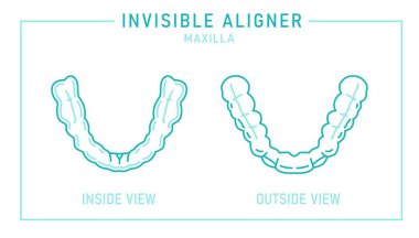 Ortodontik silikon eğitmeni. Görünmez diş telleri hizalayıcı, diş teli. Tıbbi entrika. İçeriden ve dışarıdan. Alt çene. Yatay poster. Beyaz arkaplanda izole edilmiş düzenlenebilir vektör illüstrasyonu.