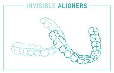 Ortodontik silikon eğitmeni. Görünmez diş telleri hizalayıcı, diş teli. Dış görünüş. Alt, üst çene. Mandibula, Maxilla. Yatay tıbbi poster. Beyaz arkaplanda düzenlenebilir vektör illüstrasyonu.