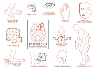 Parkinsons disease symptoms. Mental deficiency, unstable posture, rigidity, drooling. Medical infographic with linear icons. Editable vector illustration in line style isolated on a white background clipart