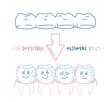 Ortodontik silikon eğitmeni. Görünmez diş telleri hizalayıcı, diş teli. Çizgisel tarzda komik dişli karakterler. Alt çene. Yatay görüntü. Beyaz arkaplanda izole edilmiş düzenlenebilir vektör illüstrasyonu.