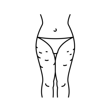 Selülit taslak simgesi. Gynoid Lipodystrophy lineer pictogram. Adiposis ödemosa sembolü. Düzenlenebilir felç. Tıbbi, sağlık hizmeti konsepti. Beyaz arkaplanda izole edilmiş vektör illüstrasyonu