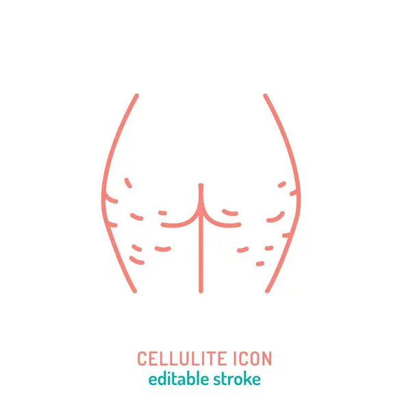 stock vector Cellulite outline icon. Gynoid lipodystrophy linear pictogram. Adiposis edematosa symbol. Editable stroke. Medical, healthcare concept. Vector illustration isolated on a white background