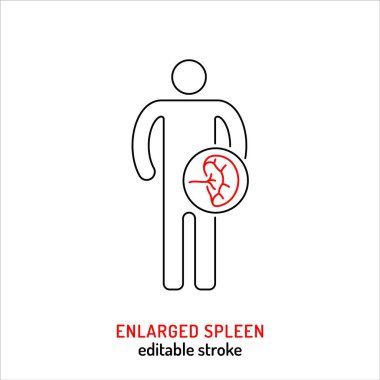 Büyümüş dalak çizgisi ikonu. Tıbbi semptomların ana hatları. Görkemli bir resim grafiği. Siyah ve kırmızı renkte basit bir sembol. Düzenlenebilir felç. Beyaz arkaplanda izole edilmiş vektör illüstrasyonu