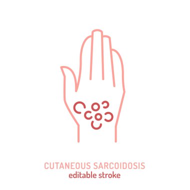 Cutaneous sarkoidoz ikonu, pictogram. Granülomatoz deri iltihabının düzenlenebilir çizimi. Tıp eğitiminde kullanılan dermatoloji sembolü, otoimmün hastalık farkındalığı ve teşhis.