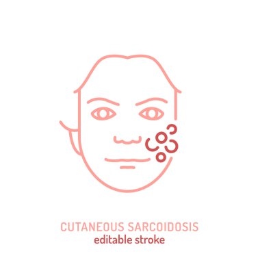 Cutaneous sarkoidoz ikonu, pictogram. Granülomatoz deri iltihabının düzenlenebilir çizimi. Tıp eğitiminde kullanılan dermatoloji sembolü, otoimmün hastalık farkındalığı ve teşhis.