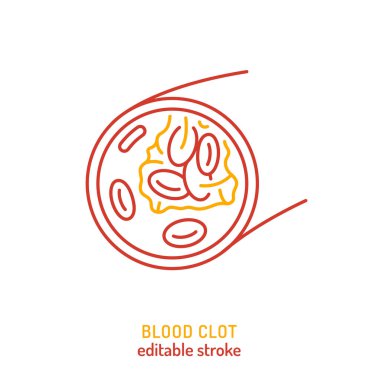 Kan pıhtısı ikonu. Trombositlerle damar tıkanıklığının düzenlenebilir çizimi. Sağlık, anatomi, felç önleme, tromboz farkındalığı ve dolaşım sistemi eğitiminde kullanılır..