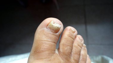 Tırnaklar ve ayak derisi iyi durumda değil, bu yüzden onlara bakılması gerekiyor..