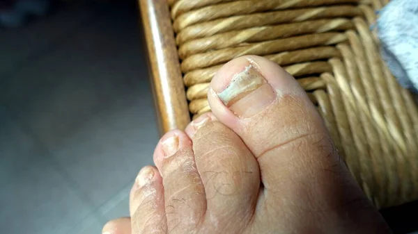 The nails and the skin of the foot are not in good condition so they need to be taken care of.