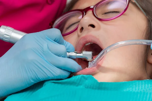 关闭一个正在清洁牙齿的女孩的嘴 — 图库照片