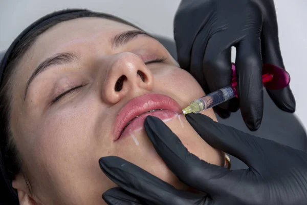 一名正在用注射器进行透明质酸治疗的年轻妇女的唇闭合 — 图库照片