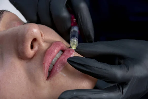 在一名注射透明质酸的年轻妇女的唇旁进行特写 — 图库照片