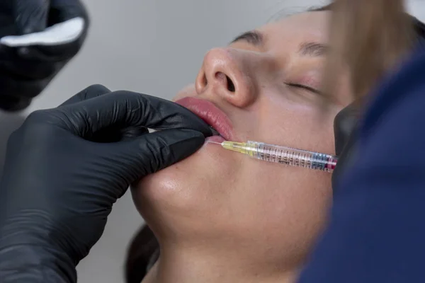 将注射器注射透明质酸到一名年轻妇女的唇上 — 图库照片