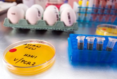 Yeni nesil H5N8 kuş gribi, insanlarda enfeksiyon, örneklerle dolu petri kabı, kavramsal görüntü