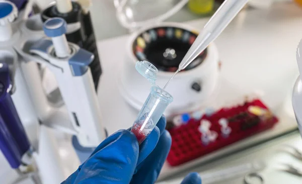 Police Scientist Analyzes Bloody Evidence Vial Discover Identity Suspect Dna — Stock Photo, Image