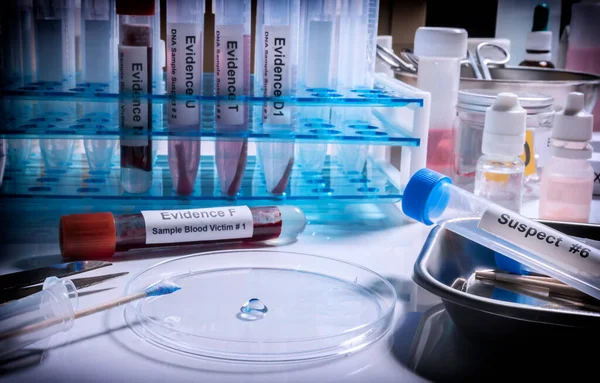 Análise Hematológica Com Kit Testes Forenses Num Homicídio Num Laboratório — Fotografia de Stock